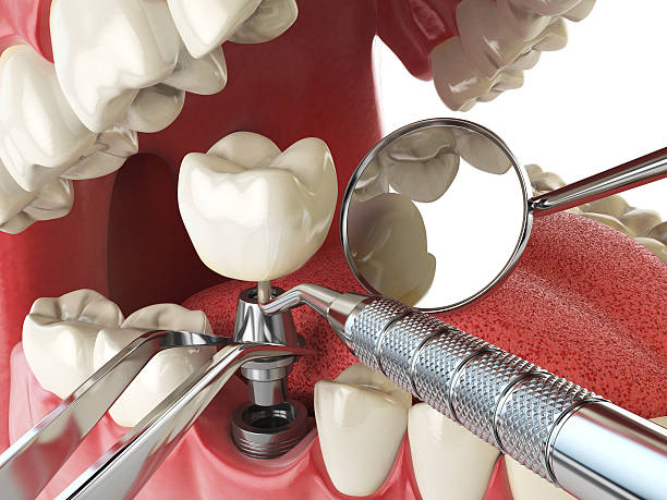 Best Emergency Denture Repair in World Golf Village, FL